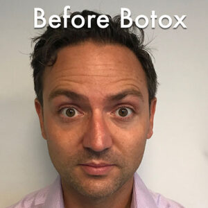 1729197255-botox-0518
