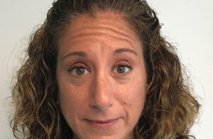 1729197285-botox-6ee8