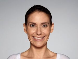 1729199322-restylane-defyne-b568