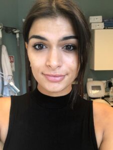 1729199475-hydrafacial-71e5