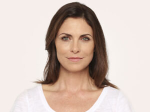 1729199817-radiesse-c360