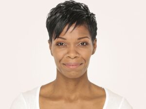 1729199825-radiesse-8c0a